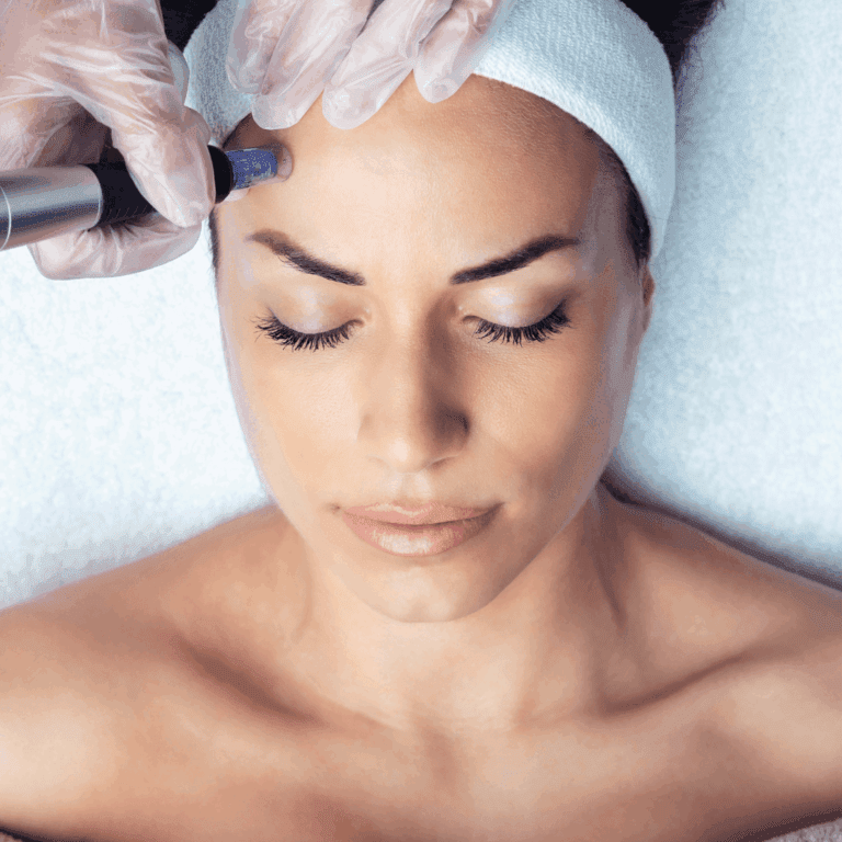 Microneedling (Dermapen), Θεραπεία για Φυσική Αναγέννηση του Δέρματος